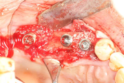 Img 0485 xdvs9h - Eugenol