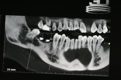 Img 0575 mfhjno - Eugenol