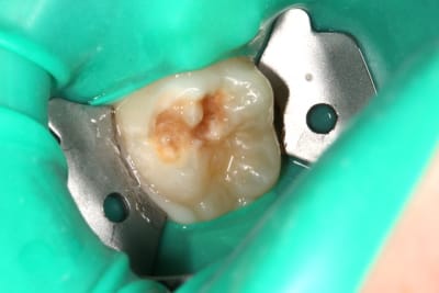 Img 0621 ugzp4s - Eugenol