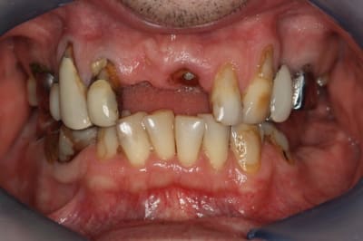 Img 0650 fjfzgn - Eugenol