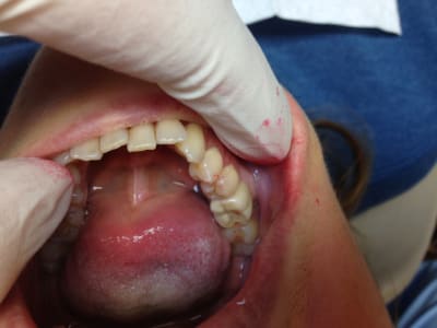 Img 0713 ohxsnw - Eugenol