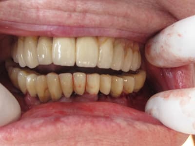 Img 0791 ofkk3p - Eugenol