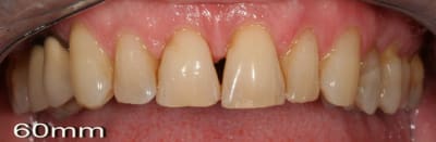 Img 0811 kcacsr - Eugenol