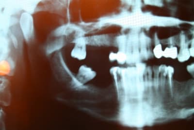 Img 0813 small psihwz - Eugenol