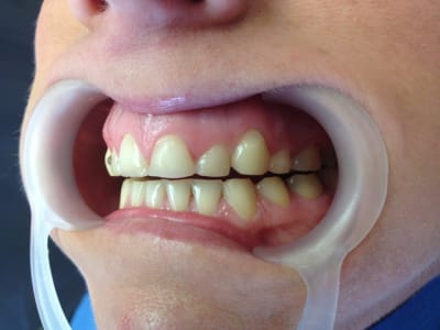 Img 0844 y3fm14 - Eugenol