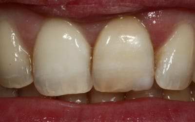 Img 0846 001 fdlirb - Eugenol