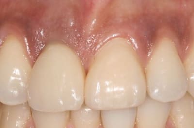 Img 0869 puwzwy - Eugenol