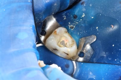 Img 0871 qk7jd8 - Eugenol