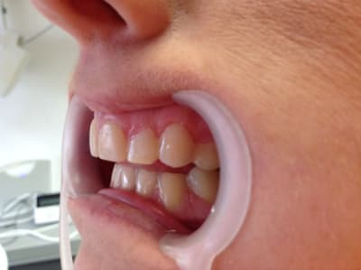 Img 0878 y00nbj - Eugenol