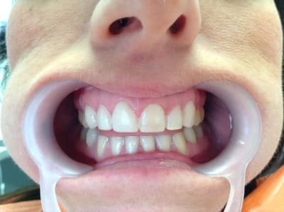 Img 0884 zpwkpa - Eugenol