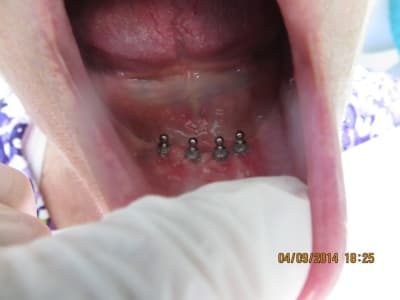 Img 0997 yfsnuy - Eugenol