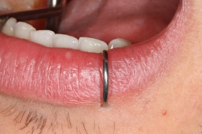 Img 1033 z2peu2 - Eugenol