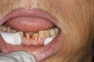 Img 1078 gnc3y4 - Eugenol