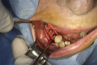 Img 1171 igjjmk - Eugenol