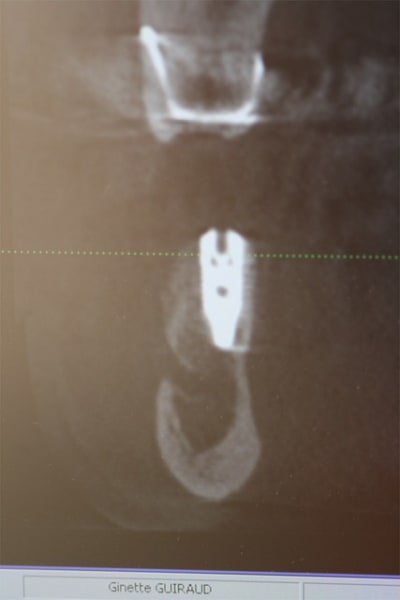 Img 1179 a13ds8 - Eugenol