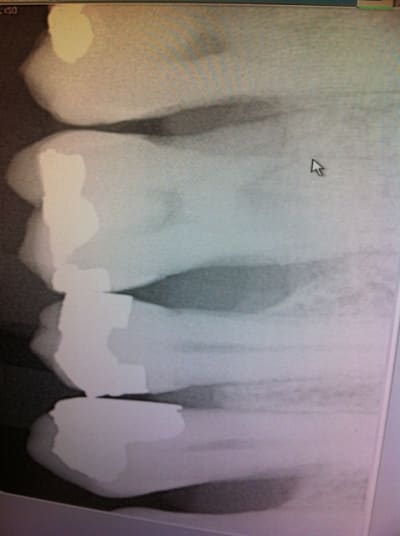 Img 1184 ut6fhv - Eugenol