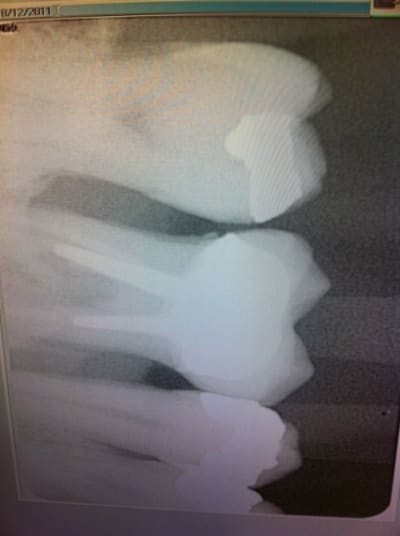 Img 1194 spvqtr - Eugenol