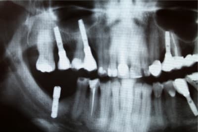 Img 1247 small n9dqrk - Eugenol