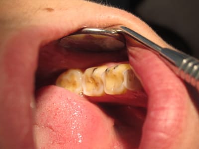 Img 1269 cat0wo - Eugenol