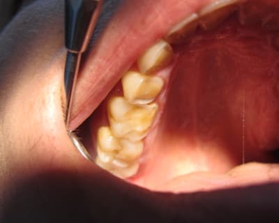 Img 1281 ibofu4 - Eugenol