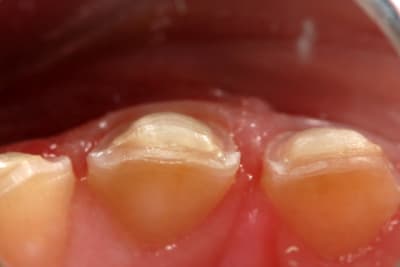 Img 1492 p5fr8u - Eugenol