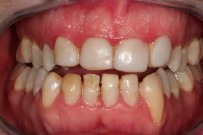 Img 1524 clpxg0 - Eugenol