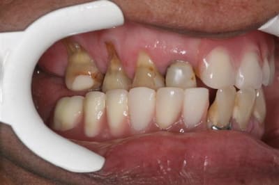 Img 1611  small  tdz7y1 - Eugenol