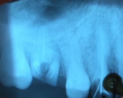 Img 1676 jb1l5i - Eugenol