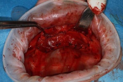 Img 1677 yjhubf - Eugenol