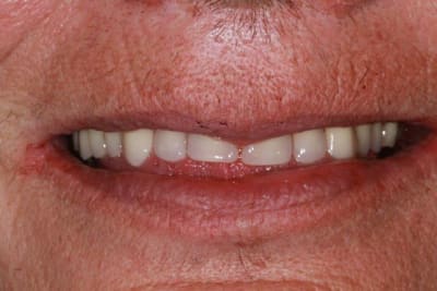 Img 1682 sktcmt - Eugenol