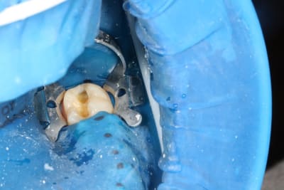 Img 1707 iafstr - Eugenol