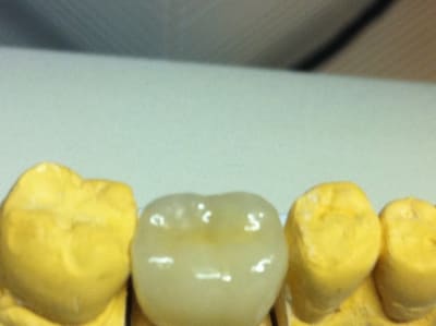 Img 1872 dweqne - Eugenol