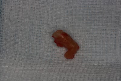 Img 1941 hgbdqj - Eugenol