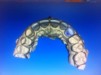 Img 1967 yohrgn - Eugenol