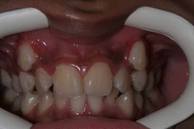 Img 1 0477 gllgih - Eugenol