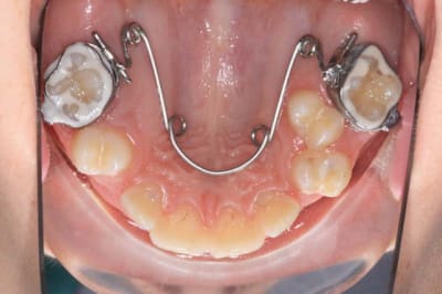 Img 1  udvmai - Eugenol