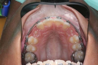 Img 1 e4jcmn - Eugenol