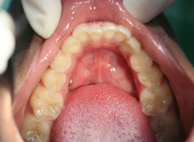 Img 1 joossp - Eugenol