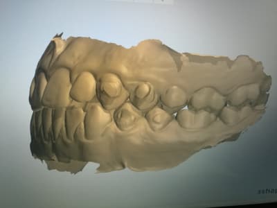 Img 20170420 164601 jwmlnu - Eugenol