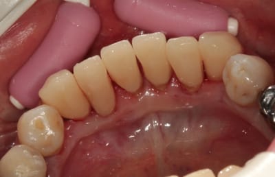 Img 2028w v3yfiw - Eugenol