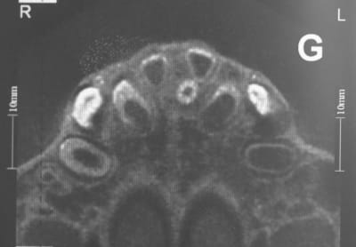 Img 2029 yrwrpo - Eugenol