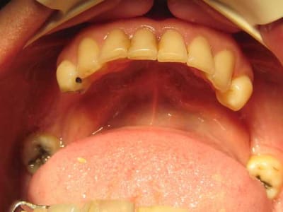 Img 2055   copie hybmei - Eugenol