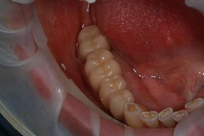 Img 2118 ynxns1 - Eugenol