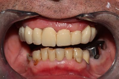 Img 2168 x8kjwe - Eugenol