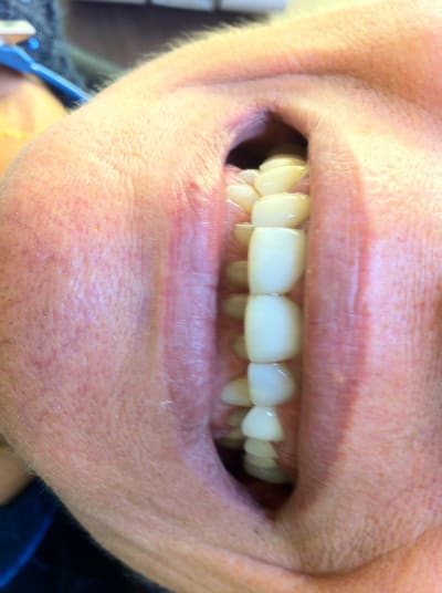 Img 2228 jdqxzg - Eugenol