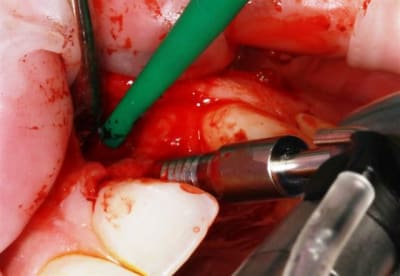 Img 2243 bohuup - Eugenol