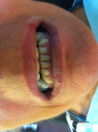 Img 2243 huk5ru - Eugenol