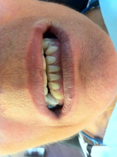 Img 2244 he9i6d - Eugenol