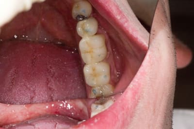 Img 2246 f5ytgz - Eugenol