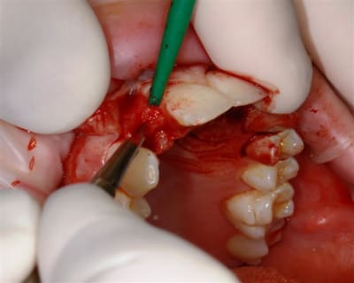 Img 2248 lxtzib - Eugenol